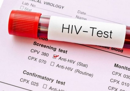 آیا HIV به صورت طبیعی درمان می شود؟