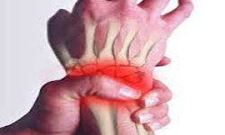 نتیجه تصویری برای شکستگی استخوان مچ دست در افراد مبتلا به پوکی استخوان