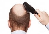 درمانی طبیعی برای جلوگیری از ریزش مو