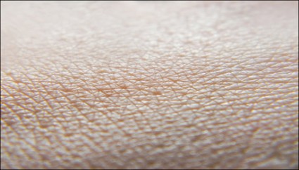 سرطان پوست؛ علل ایجاد و علائم آن