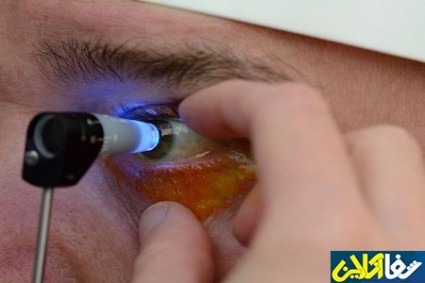 40 نشانگر ژنتیکی عامل بروز بیماریهای چشمی شناسایی شدند