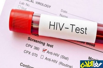 بهترین زمان برای آزمایش HIV چند ماه بعد از رابطه جنسی می باشد؟
