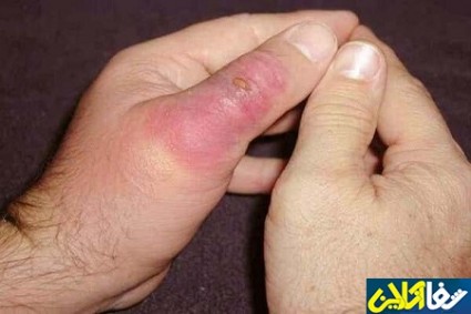 نیش مار و عقرب سال گذشته چند ایرانی را راهی بیمارستان کرد؟