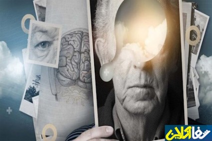 زوال عقل و آلزایمر در کمین چه کسانی است؟