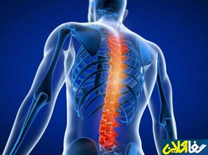 همه چیز در خصوص جراحی ستون فقرات