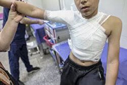 حادثه ای دردناک به نام «سوختگی» در ایران!