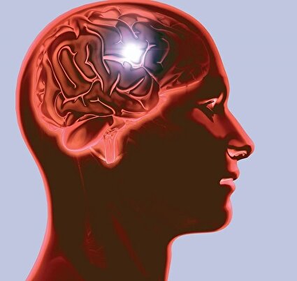 سهم ایران از سکته مغزی