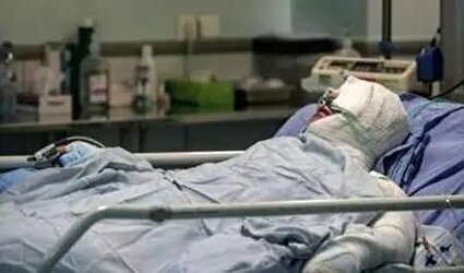 اعلام آمار سالانه سوختگی در ایران/ چند نفر از مصدومان فوت می‌شوند؟