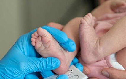 غربالگری نوزادان پیشگیری از عوارض مادام‌العمر کم‌کاری تیروئید