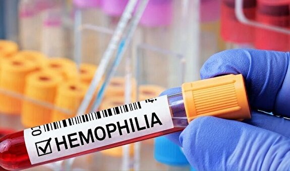 چالش‌های پیش روی بیماران هموفیلی در ایران