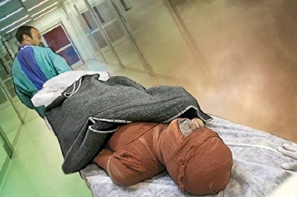 کمبود هزار تخت بیمارستانی سوختگی در کشور
