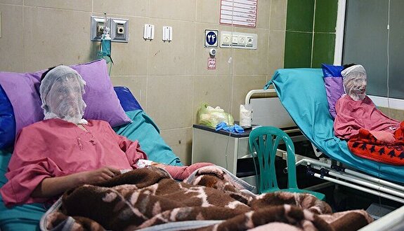 حتی یک تخت استاندارد سوختگی در بخش دولتی نداریم