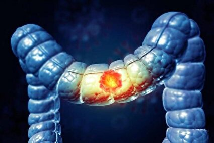 خطر پنهان سرطان با مصرف الکل؛ راه امید به کاهش خطر