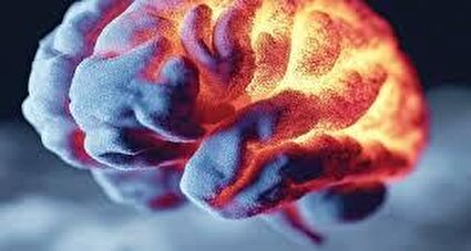بیماری خاموش مغز