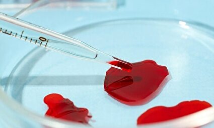 راهی ساده‌تر برای غربالگری سرطان دهانه رحم