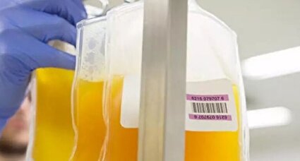 ۲ هزار بیمار در کشور پلاسما درمانی شدند