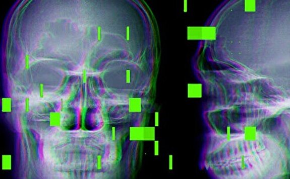 خطرات هوش مصنوعی برای بیماران نیازمند جراحی