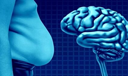 حقایقی درباره ارتباط چربی با کاهش حجم مغز