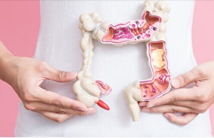 افزایش سرطان روده بزرگ در زنان/ آیا غذاهای فوق‌فرآوری‌شده مقصرند؟