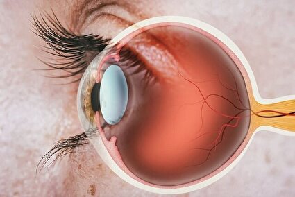 سلول‌های بنیادی و امید به بازیابی بینایی