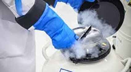 چه کسانی نیاز به فریز تخمک دارند؟