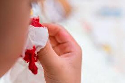 وقتی خون‌دماغ خطرناک می‌شود
