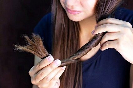 یکی از علل چرب شدن موی سر/راههای درمان خانگی