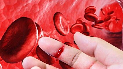 هموفیلی را بیشتر بشناسیم، از علائم تا کنترل بیماری