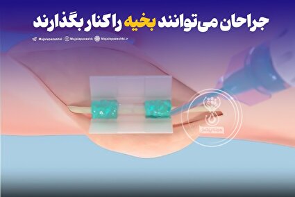جراحان می‌توانند بخیه را کنار بگذارند!