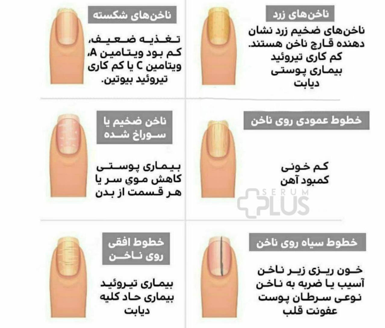 اگر ناخن ها صحبت می‌کردند/اینفوگرافیک