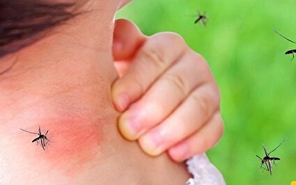 پشه‌ها را با بوی بد دور کنید