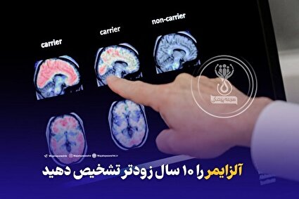 آلزایمر را 10 سال زودتر تشخیص دهید