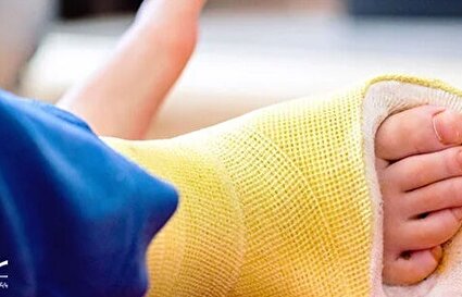 ترمیم شکستگی در سه دقیقه با یک تزریق