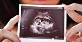 غربالگری نه محدود شده نه ممنوع