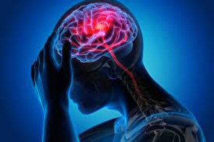 علائم رایج سکته مغزی کدامند؟
