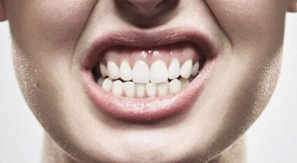 دندان‌قروچه؛ پیام پنهان خشم و استرس شما