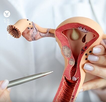 چگونه از افتادگی رحم پس از یائسگی جلوگیری کنیم؟