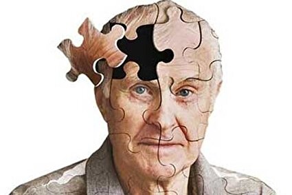 آلودگی هوا و آلزایمر