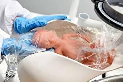 اختراع رحم مصنوعی برای نجات نوزادان زودرس از مرگ