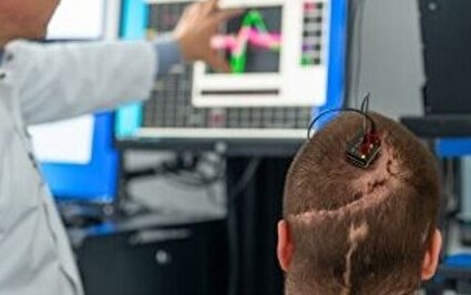 کاشت رابط مغز و رایانه در بیمار مبتلا به فلج کامل برای نخستین‌بار در اروپا