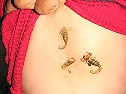 اگر عقرب نیشت زد/ اینفوگرافیک