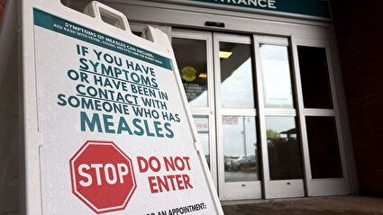 کانادا وضعیت «حذف سرخک» را از دست داد