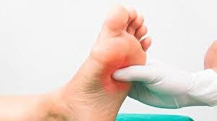 زخم نوروپاتیک در بیماران دیابتی/فیلم