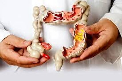 علائم اولیه سرطان روده/فیلم