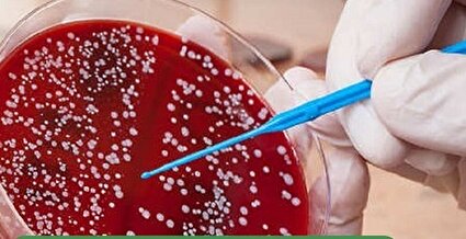 ایران در ذخیره سازی خون بند ناف رتبه جهانی دارد