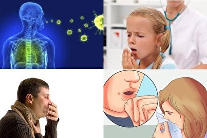 رکورد شکنی بیماری سل در سال گذشته