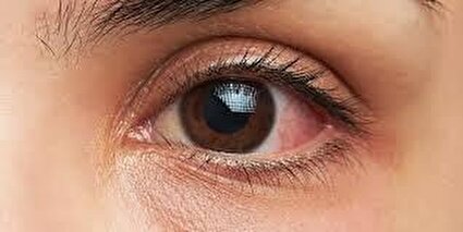 این نشانه‌های چشمی را جدی بگیرید /فیلم