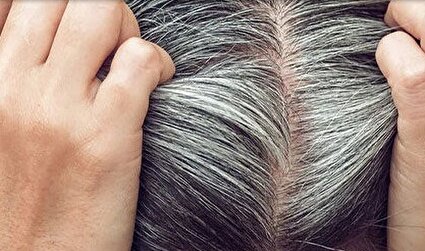 طب سنتی و علت سفیدی موها