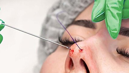 سازمان نظام پزشکی فعالیت بلاگرهای حوزه زیبایی را ارزیابی می‌کند