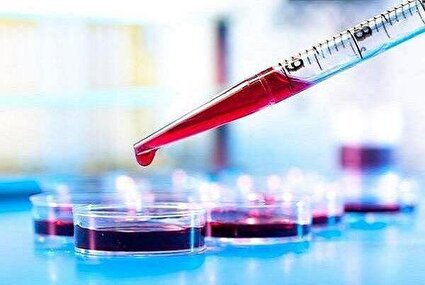 خون پیر؛ عامل تسریع پیشرفت آلزایمر